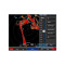 Морський радар Garmin GMR18 xHD